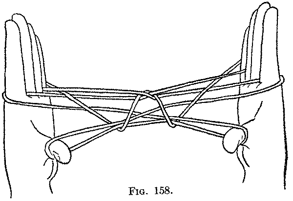 Fig. 158