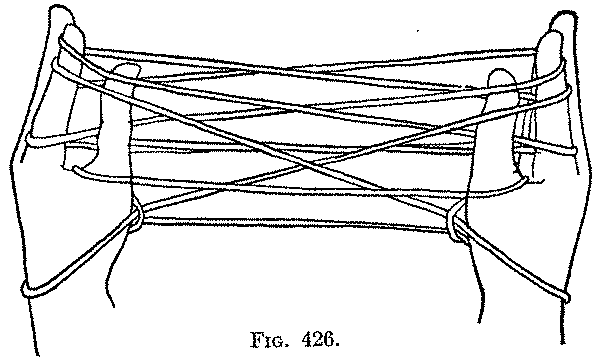 Fig. 426