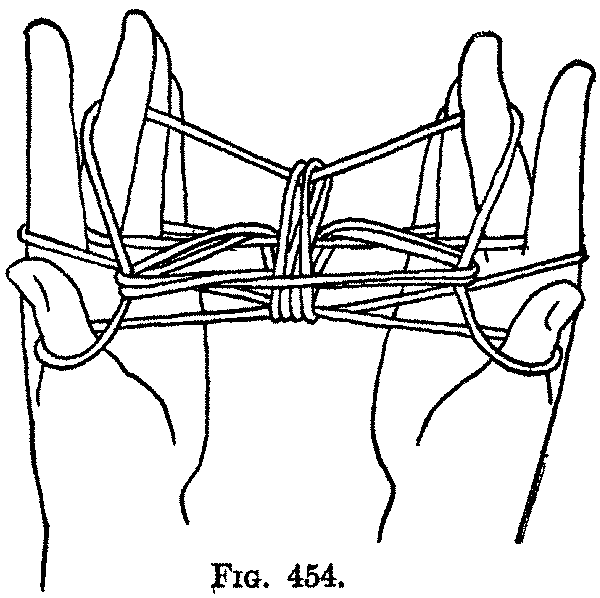 Fig. 454