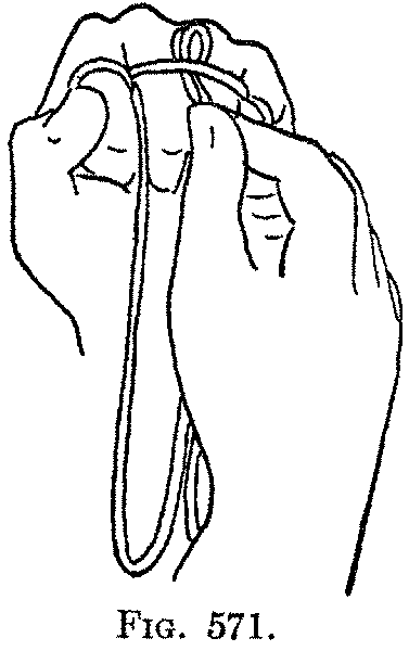 Fig. 571