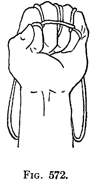Fig. 572
